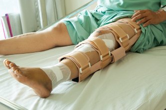 Уход при переломе шейки бедра Перелом шейки бедра